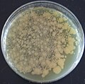 Miniatura para Bacteria modificada genéticamente