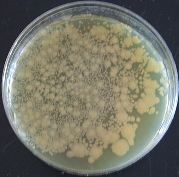 Bacteria modificada genéticamente