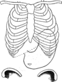 Fig. 72. — Position verticale de l'estomac distendu, d'après Rosenheim Sa situation pendant le gonflement. Bord inférieur du foie.