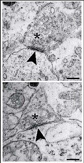 <span class="mw-page-title-main">Postsynaptic density</span>