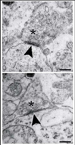 Postsynaptic density.jpg