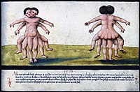 Folio 93. Monstrous birth (1513)