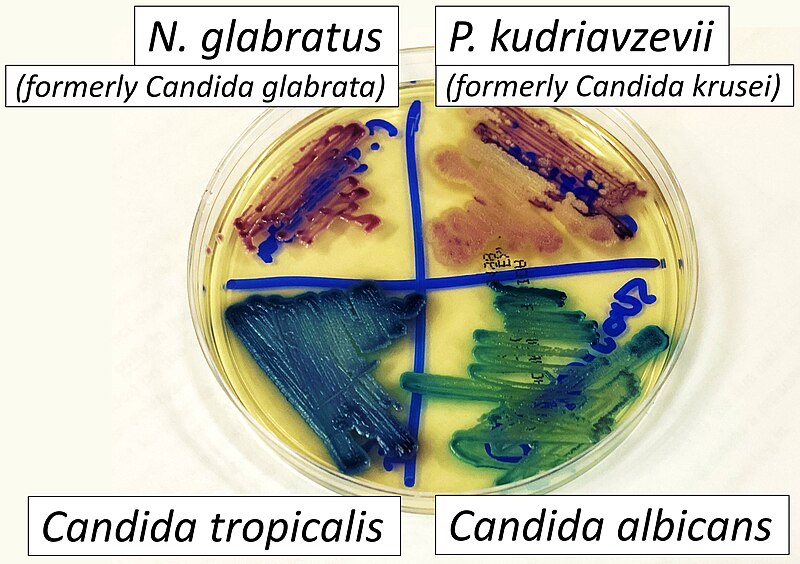 File:CHROMAgar with N glabratus, P kudriavzevii, Candida albicans and Candida tropicalis, annotated.jpg