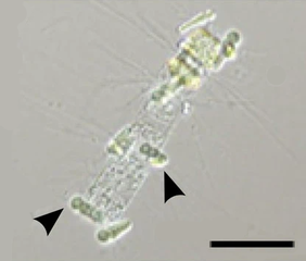 Epiphytic Calothrix cyanobacteria (arrows) in symbiosis with a Chaetoceros diatom. Scale bar 50 μm.