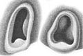 Ventral views of funnel locking-apparatuses (left: 27 mm ML, right: 35 mm ML)