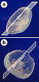 Radial plane of section in a cnidarian.