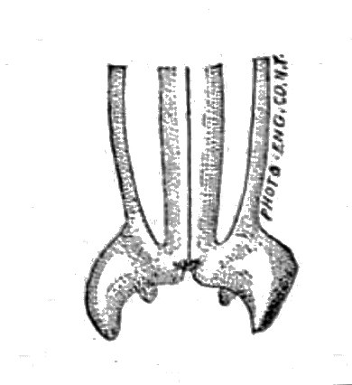 File:Trichinella spiralis (37).tif