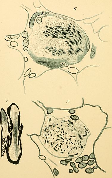 File:Anatomische Hefte (1898) (18144824856).jpg