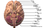 Thumbnail for Neurosarcoidosis