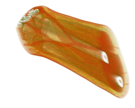 Volume rendered CT scan of a forearm with different colour schemes for muscle, fat, bone, and blood