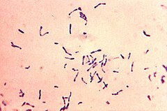 Description de l'image Corynebacterium diphtheriae Gram stain.jpg.