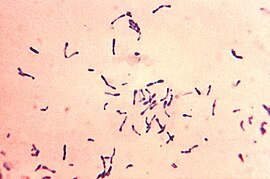 Corynebacterium diphtheriae Gram stain.jpg