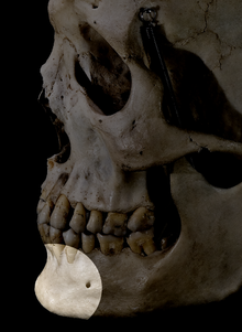 Photo showing the chin of a human skull Crane3chin.png