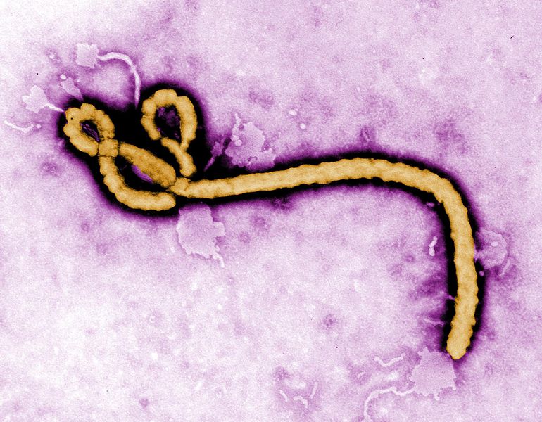 [Image: 770px-Ebola_virus_(2).jpg]