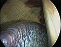 Laparoskopisk bilete av milten til ein hest (det lilla-grå organet)