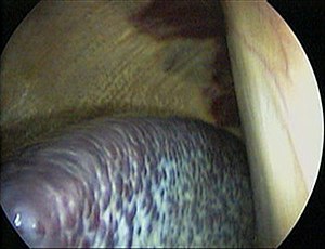 Horse spleen laparoscopic.jpg