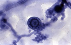Azul de metileno - Wikipedia, la enciclopedia libre