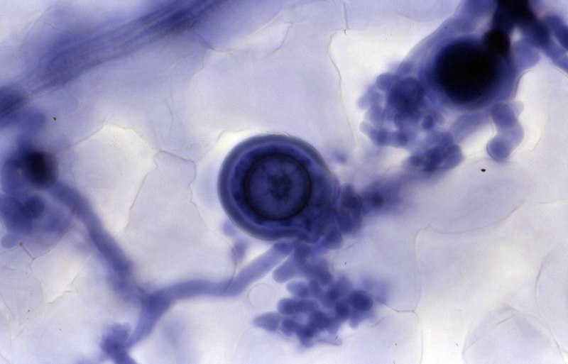 File:Hyaloperonospora-parasitica-hyphae-oospore.jpg