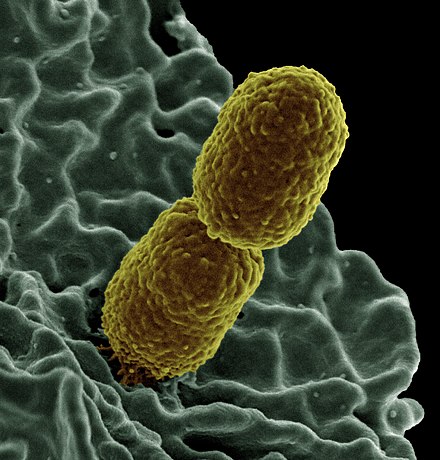 Colorized scanning electron micrograph showing carbapenem-resistant Klebsiella pneumoniae interacting with a human neutrophil. Klebsiella pneumoniae Bacterium (13383411493).jpg