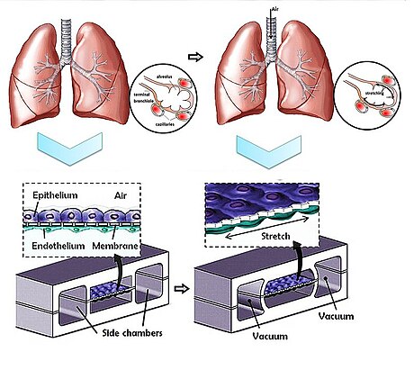 Lung-on-a-chip