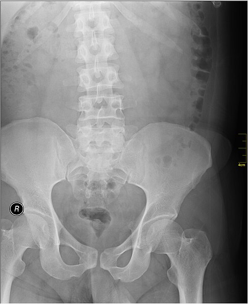 File:Medical X-Ray imaging TCI07 nevit.jpg