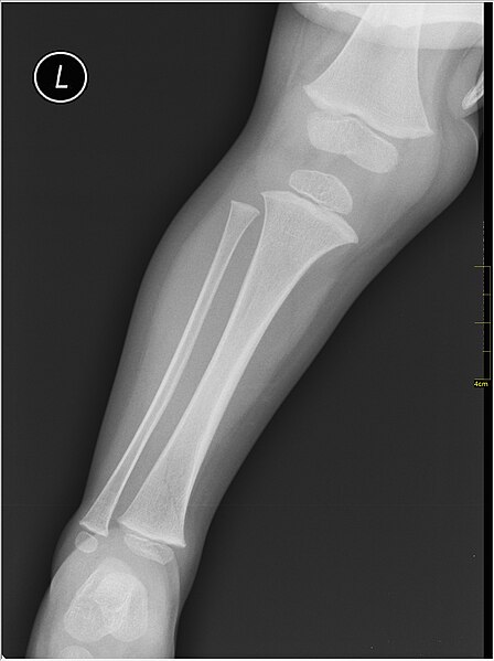 File:Medical X-Ray imaging TNR07 nevit.jpg