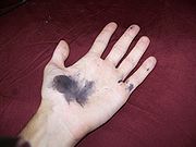 180px-Silver_nitrate_stains.jpg