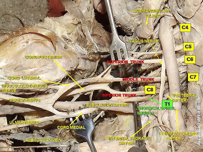 File:Slide6y.JPG