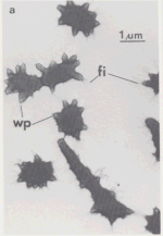 Thumbnail for Verrucomicrobium spinosum