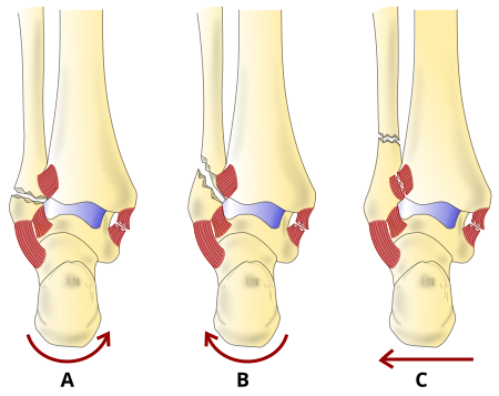 Phép phân loại Danis–Weber