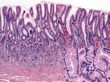 Het maagslijmvlies (antrale mucosa), H&E-gekleurd. Bovenaan de coupe zijn geplooide, secretoire cellen zichtbaar.