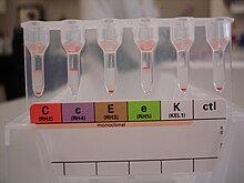 Blood typing for the RhC/c, RhE/e and K antigens Kell and extended Rh antigen blood typing.jpg