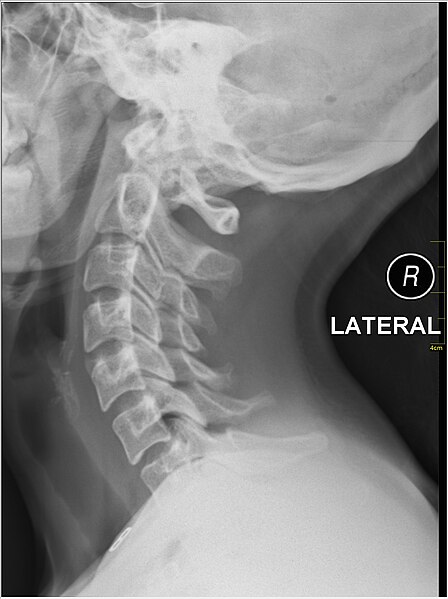 File:Medical X-Ray imaging QBQ06 nevit.jpg