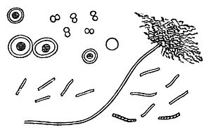 PSM V06 D418 Bacteria leptothrix and spore like bodies.jpg