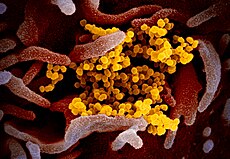 Het nieuwe coronavirus SARS-CoV-2 (geel) uit gekweekte cellen van een patiënt