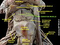 Disecció. Entre altres, el múscul geniohioidal.