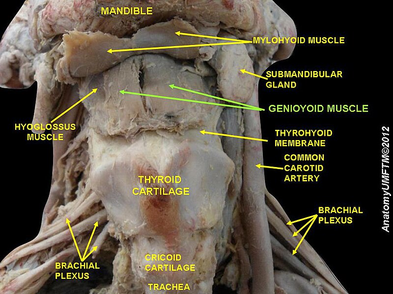 File:Slide1ss.JPG