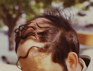 <span class="mw-page-title-main">Comb over</span> Hairstyle