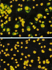 Immunoflourescence: Cells infected by rotavirus (top) and uninfected cells (bottom) Virus Infected Cells.jpg