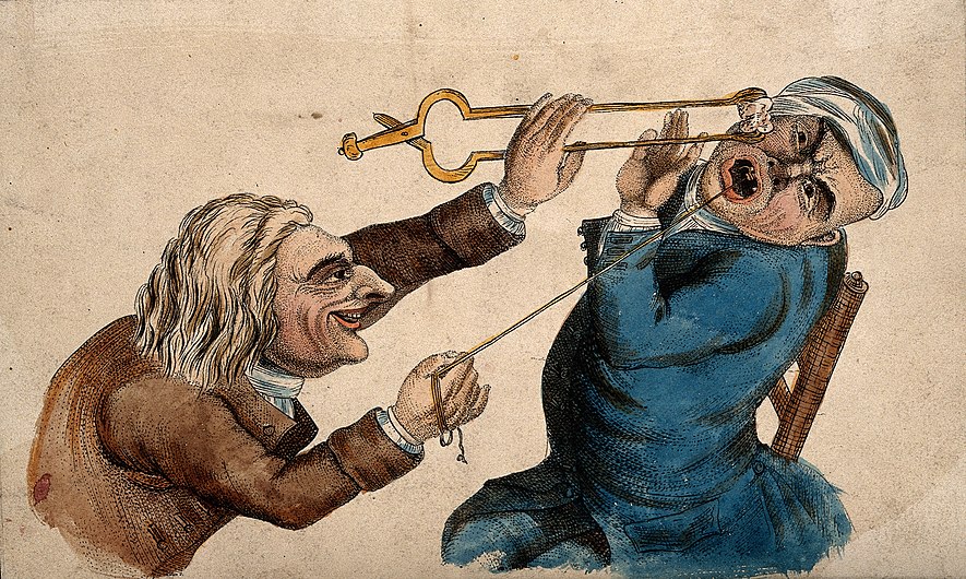 A sadistic tooth-drawer frightening his patient with a hot c Wellcome V0012044.jpg