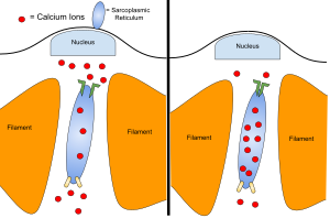 Anaerobic Exercise