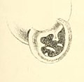 Boston Journal of Natural History, v.7.-Plate 4-fig16-Pupa Gibbosa.jpg