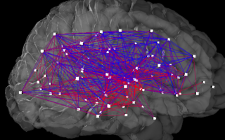 <span class="mw-page-title-main">Budapest Reference Connectome</span>