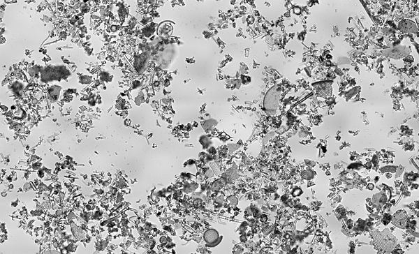 Diatomaceous earth, a biogenic form of silica as viewed under a microscope. The imaged region measures approximately 1.13 by 0.69 mm.