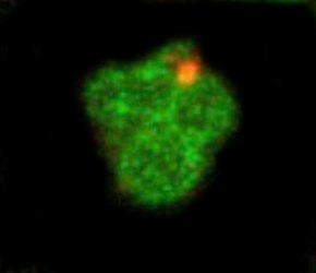 An IPOD inclusion viewed by a non-ubiquitinated VHL protein(red), tethered to the vacuole (green). IPOD (red) tethered to the vacuole (green).tif