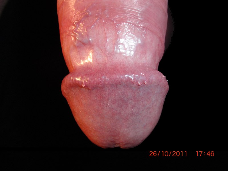 File:Male genital anatomy - penis glans close-up (Anatomie der männlichen Genitalien - Nahaufnahme der Eichel)-b.jpg