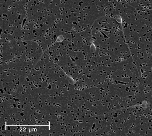 Spermatozoa, in this case human, are a primary component in normal semen, and the agents of fertilization of female ova.