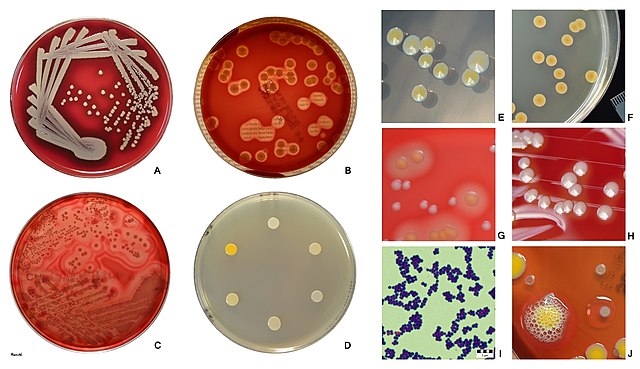 File:Staphylococcus aureus Gram stain.jpg - Wikimedia Commons