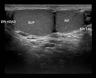 <span class="mw-page-title-main">Polyorchidism</span> Medical condition