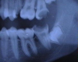 Hominisation: Anatomische Besonderheiten und Verhalten, Kulturell tradierte Merkmale, Siehe auch